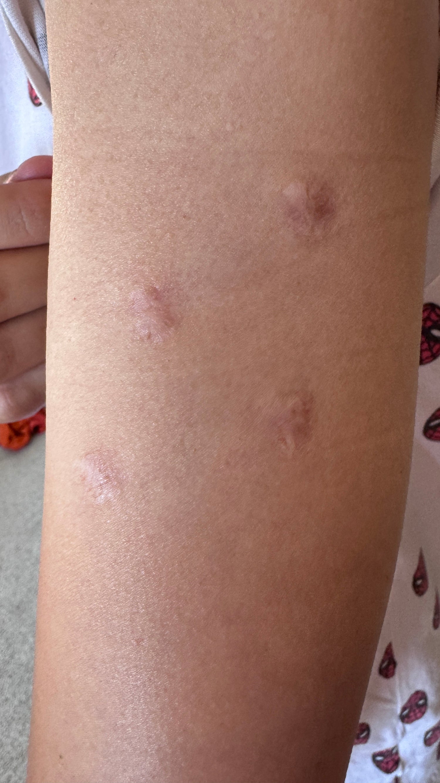 Made for Scars