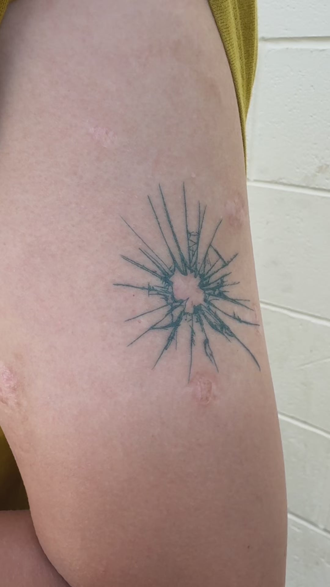 Before and after showing the Breaking Point temporary tattoo transforming a healed scar into fine line body art